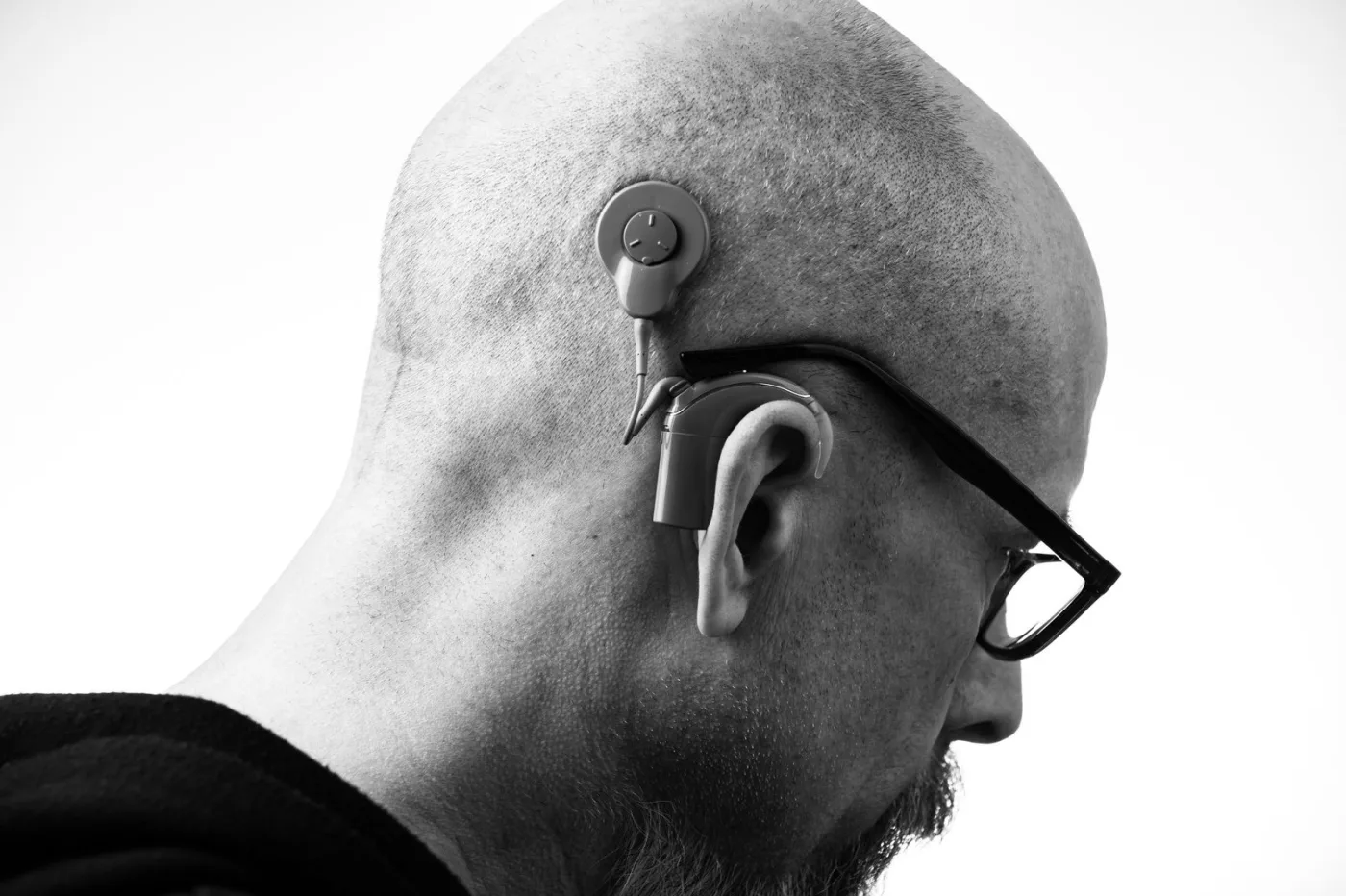 Profile view in black and white of a man wearing a behind-the-ear hearing device and cochlear implant processor